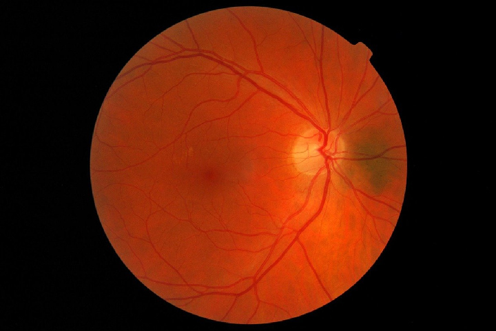 retinal image - Superior Colliculus